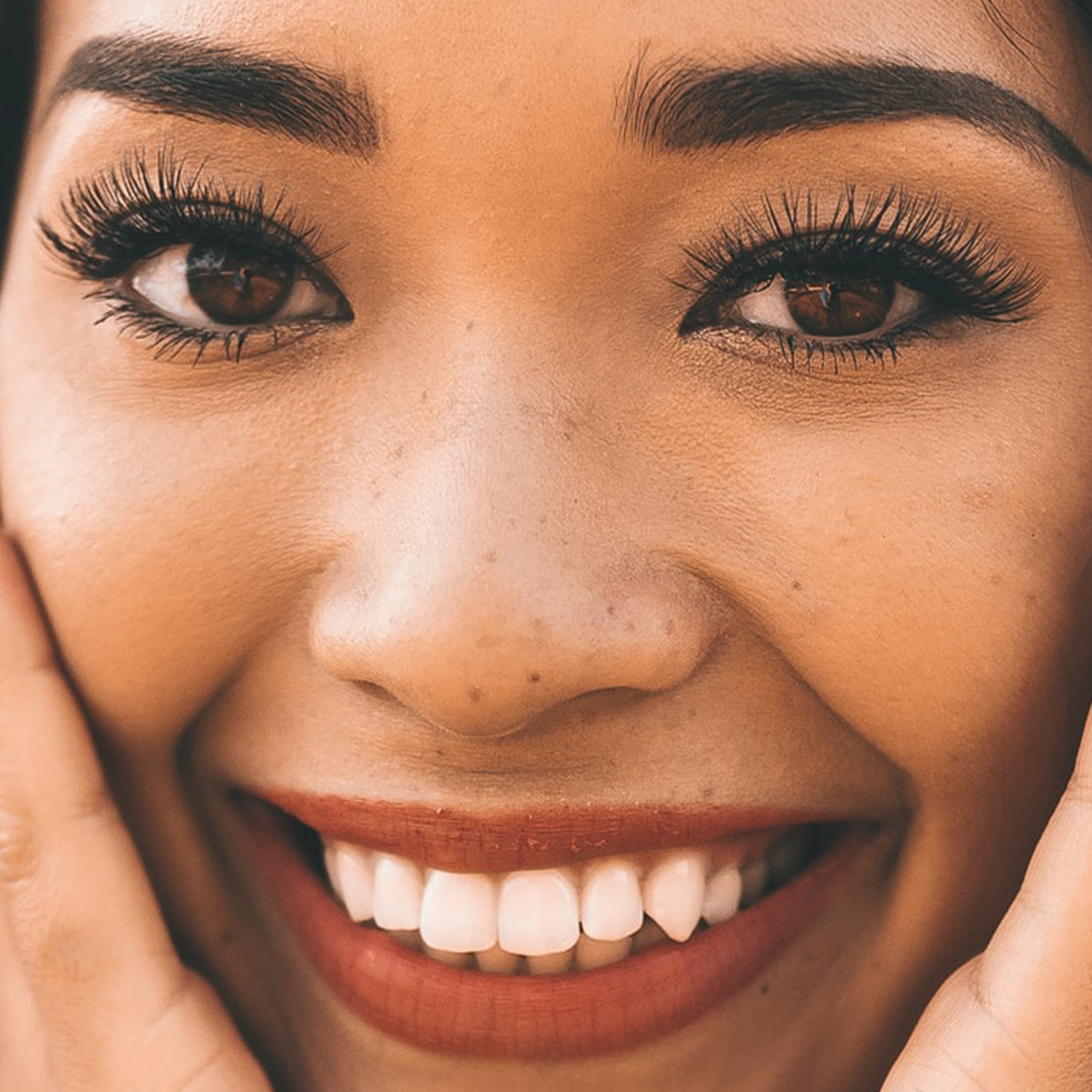 Long Term Wrinkle Fillers