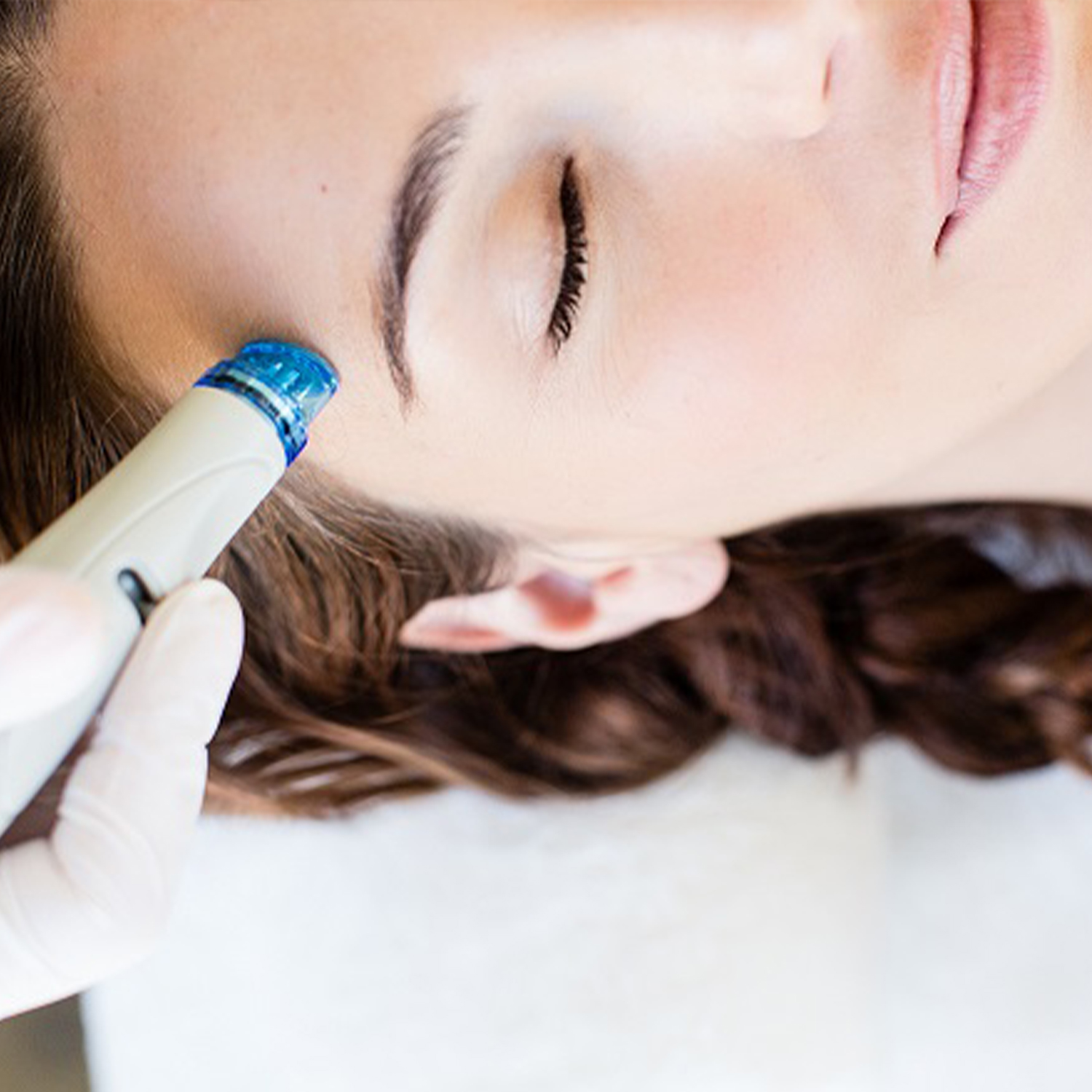 HydraFacial Syndeo