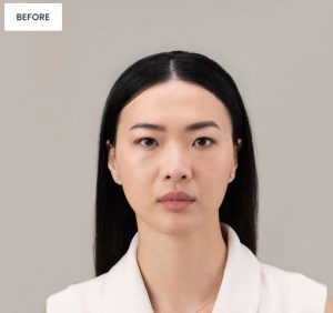 Before Before