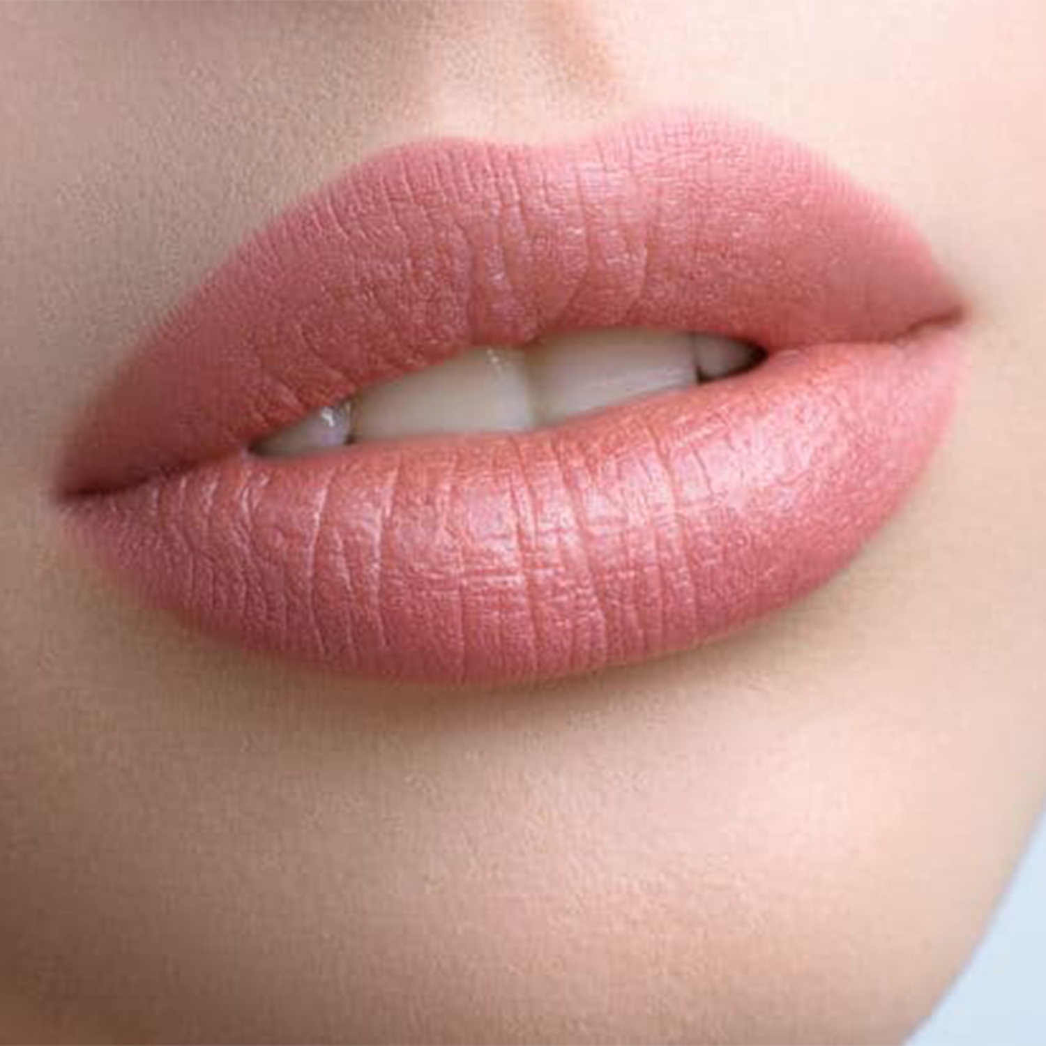 Lip Lift